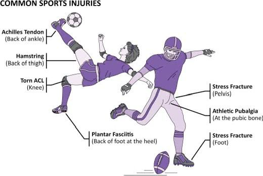 The hidden challenge: overuse injuries in youth sports.