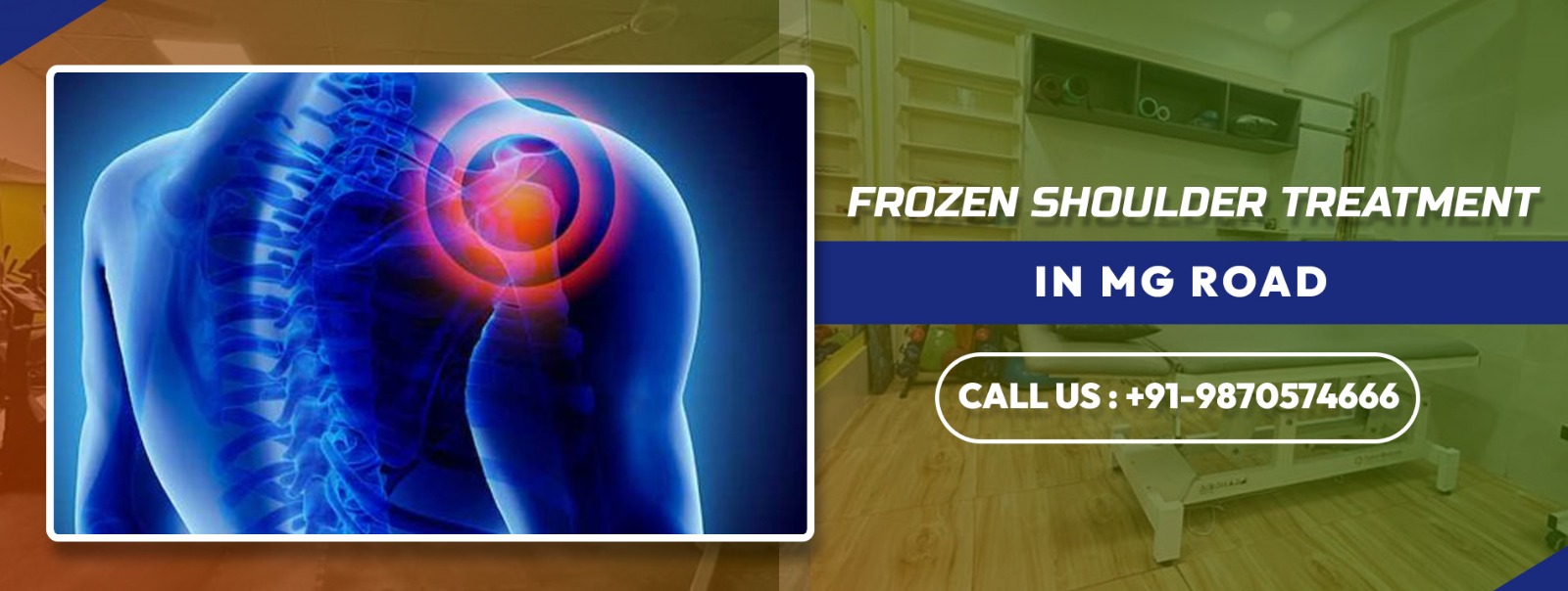 Frozen shoulder Treatment in MG Road