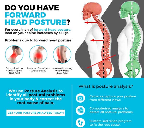 Posture, Walking Running Analysis