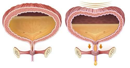 Importance of Pelvic Floor Exercises In Females