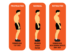 Posture, Walking & Running Analysis