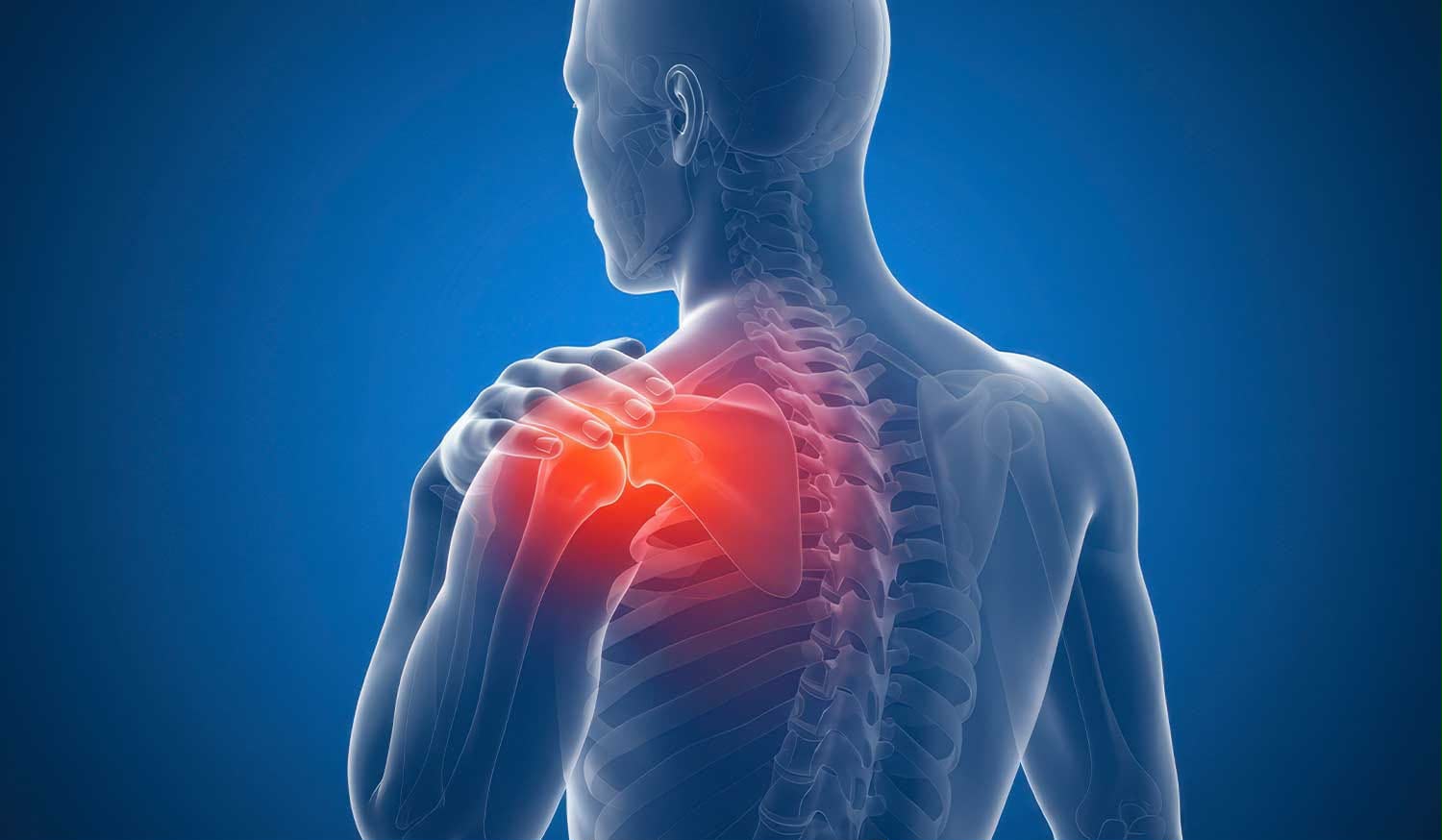 Frozen Shoulder Rehabilitation: A Successful Recovery Case